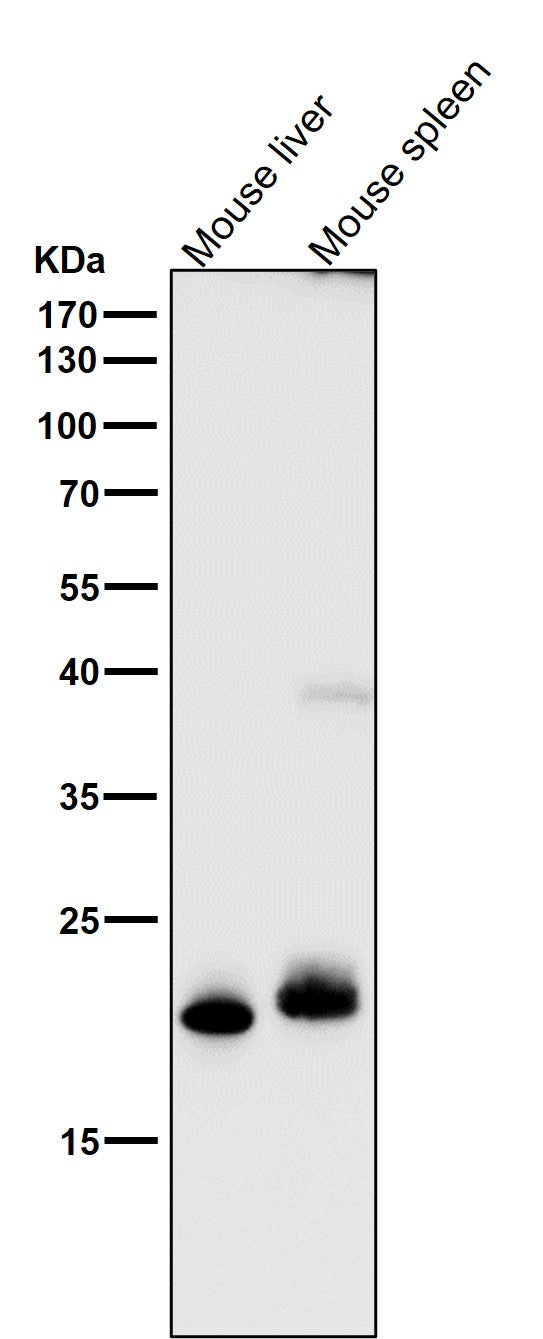 All lanes use the Antibody at 1:1K dilution for 1 hour at room temperature.