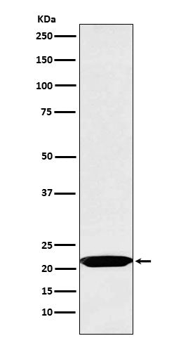 Western blot analysis of Oncostatin M expression in Jurkat cell lysate.