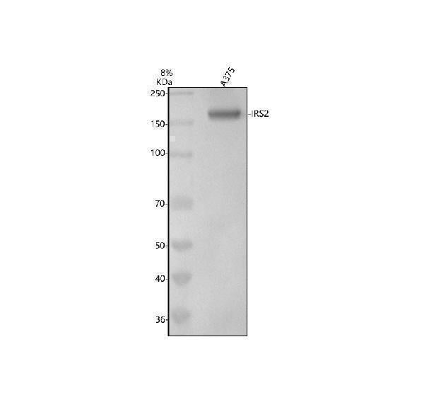 Anti-IRS2 Rabbit Monoclonal Antibody