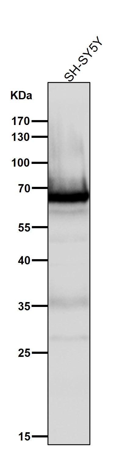 All lanes use the Antibody at 1:3K dilution for 1 hour at room temperature.