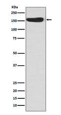 Western blot analysis of CD163 expression in Human fetal kidney lysate.