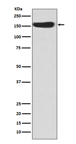 Western blot analysis of CD163 expression in Human fetal kidney lysate.