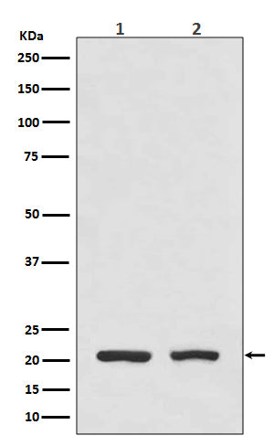 Western blot analysis of DHFR expression in (1) HeLa cell lysate; (2) Mouse spleen lysate.