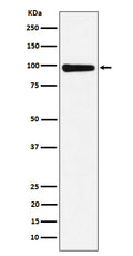 Western blot analysis of CHM expression in 293T cell lysate.
