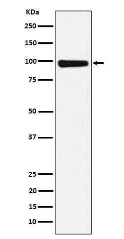 Western blot analysis of CHM expression in 293T cell lysate.