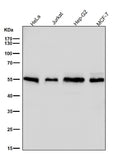 All lanes use the Antibody at 1:3K dilution for 1 hour at room temperature.