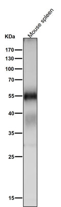 All lanes use the Antibody at 1:1K dilution for 1 hour at room temperature.