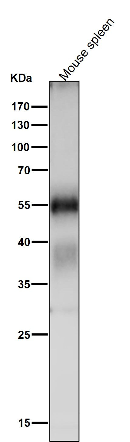 All lanes use the Antibody at 1:1K dilution for 1 hour at room temperature.