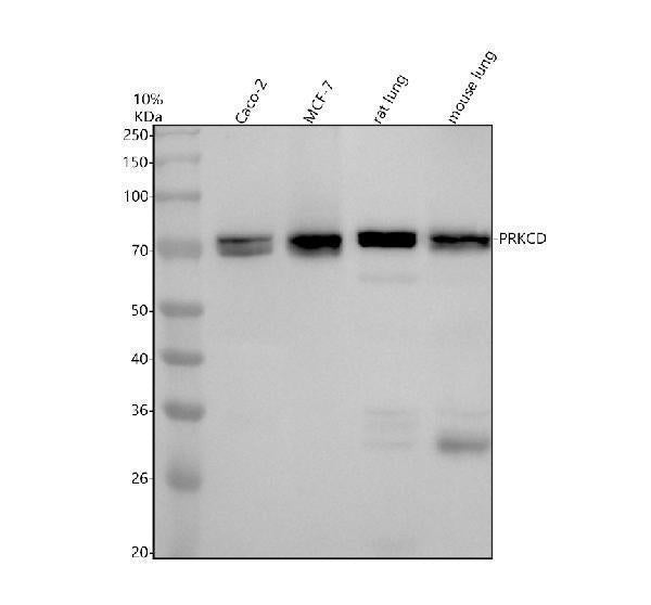 Anti-PKC delta + PKC theta Rabbit Monoclonal Antibody