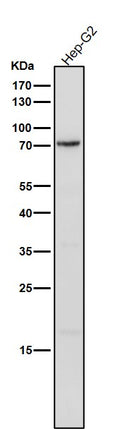 All lanes use the Antibody at 1:1K dilution for 1 hour at room temperature.