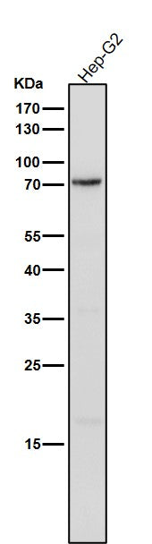 All lanes use the Antibody at 1:1K dilution for 1 hour at room temperature.