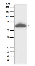 Western blot analysis of RPE65 expression in mouse eyeball lysate.