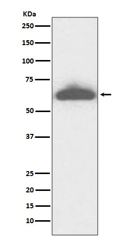 Western blot analysis of RPE65 expression in mouse eyeball lysate.