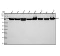 Anti-EEF2 Monoclonal Antibody