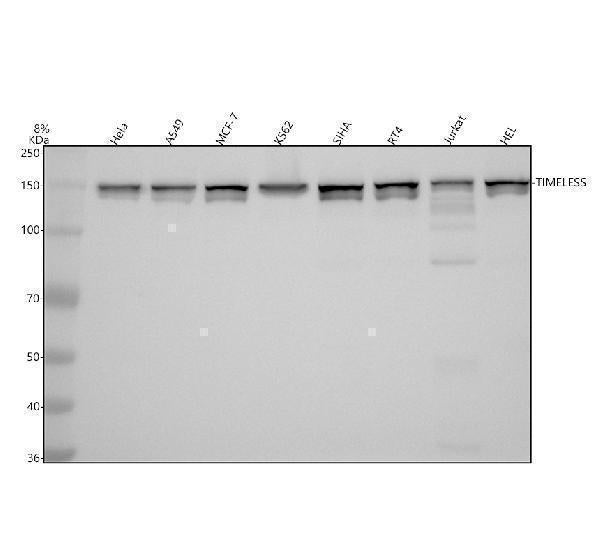 Anti-Timeless Rabbit Monoclonal Antibody
