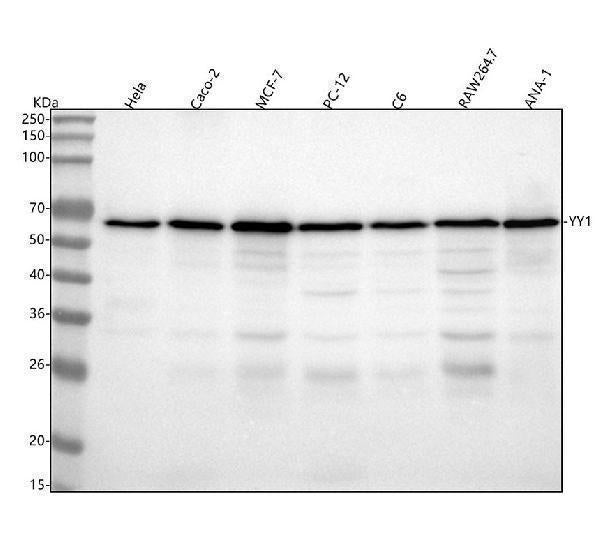 Anti-YY1 Rabbit Monoclonal Antibody
