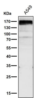 All lanes use the Antibody at 1:1K dilution for 1 hour at room temperature.