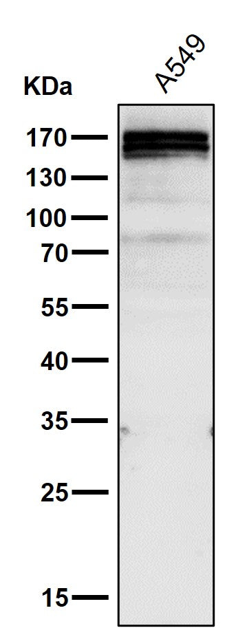 All lanes use the Antibody at 1:1K dilution for 1 hour at room temperature.