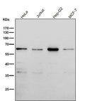 All lanes use the Antibody at 1:2K dilution for 1 hour at room temperature.