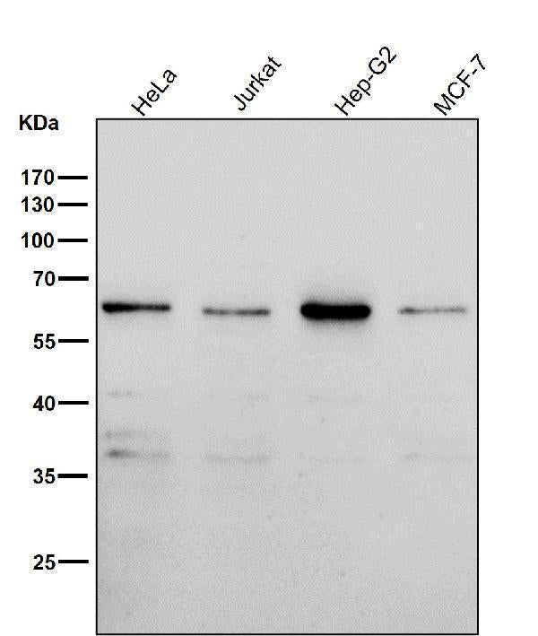 All lanes use the Antibody at 1:2K dilution for 1 hour at room temperature.