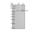 Anti-5 Lipoxygenase ALOX5 Monoclonal Antibody