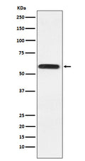 Western blot analysis of Lgi1 expression in HeLa cell lysate.