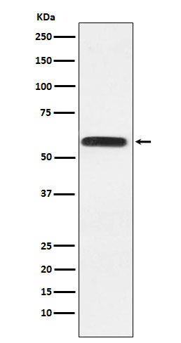 Western blot analysis of Lgi1 expression in HeLa cell lysate.