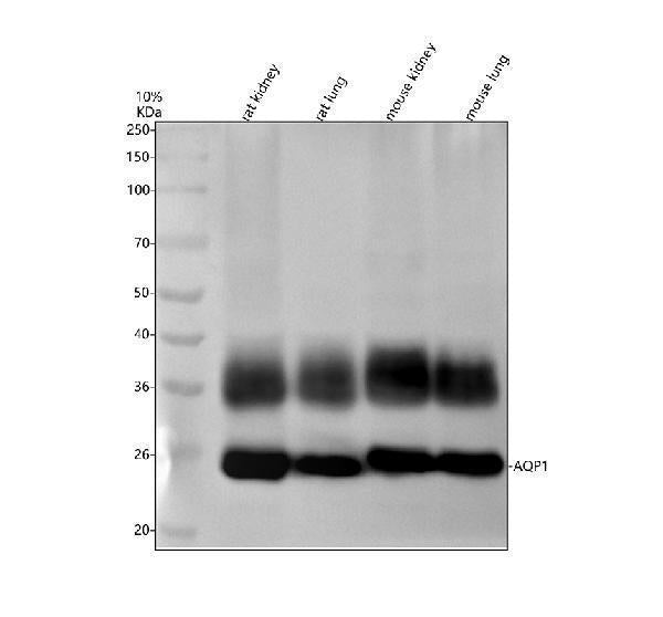 Anti-AQP1 Rabbit Monoclonal Antibody
