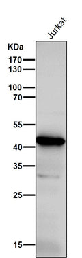 All lanes use the Antibody at 1:1K dilution for 1 hour at room temperature.