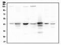 Anti-ADA Antibody Picoband® (monoclonal, 6D4)