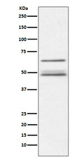 Western blot analysis of IKK gamma expression in Jurkat cell lysate.
