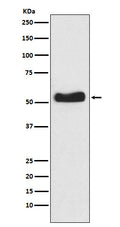 Western blot analysis of Glucokinase expression in BxPC-3 cell lysate.