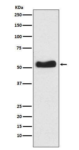 Western blot analysis of Glucokinase expression in BxPC-3 cell lysate.