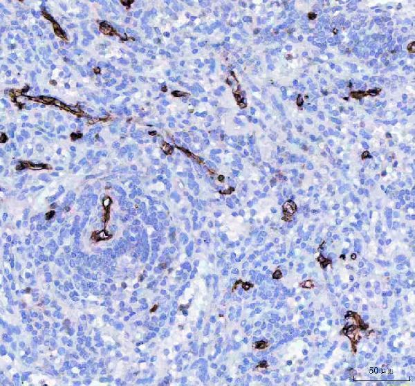 Anti-CD34 Rabbit Monoclonal Antibody