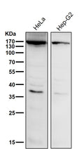 All lanes use the Antibody at 1:1K dilution for 1 hour at room temperature.