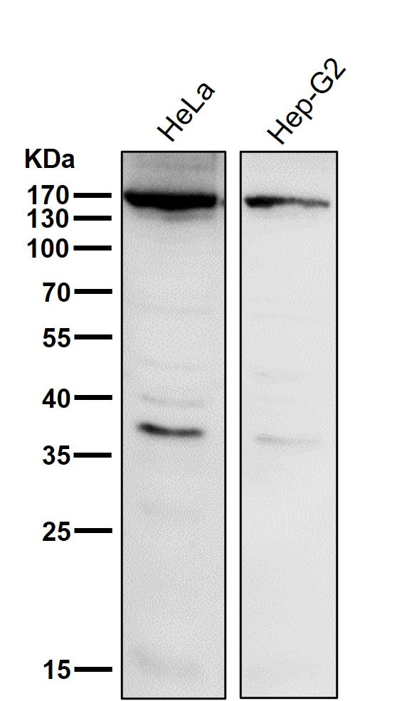 All lanes use the Antibody at 1:1K dilution for 1 hour at room temperature.