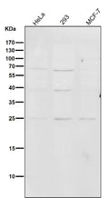 All lanes use the Antibody at 1:1K dilution for 1 hour at room temperature.