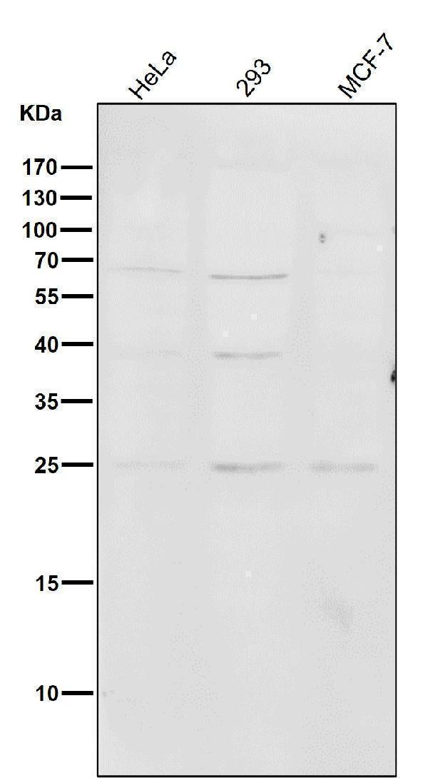 All lanes use the Antibody at 1:1K dilution for 1 hour at room temperature.
