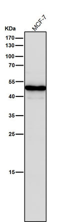 All lanes use the Antibody at 1:1W dilution for 1 hour at room temperature.