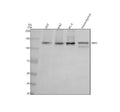 Anti-RENT1 / hUPF1 Rabbit Monoclonal Antibody