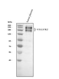 Anti-VEGF Receptor 2 KDR Rabbit Monoclonal Antibody