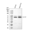 Anti-LCAT Rabbit Monoclonal Antibody