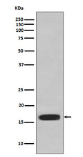 Western blot analysis of CD59 expression in HUVEC cell lysate.