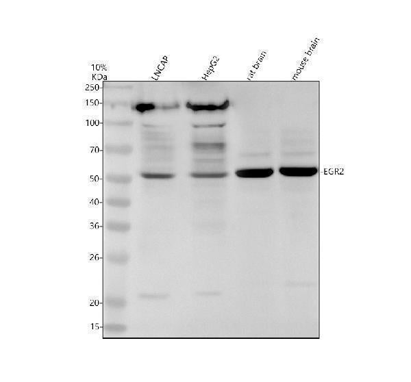 Anti-EGR2 Rabbit Monoclonal Antibody