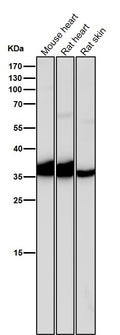 All lanes use the Antibody at 1:2K dilution for 1 hour at room temperature.
