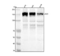 Anti-ASK1 MAP3K5 Rabbit Monoclonal Antibody
