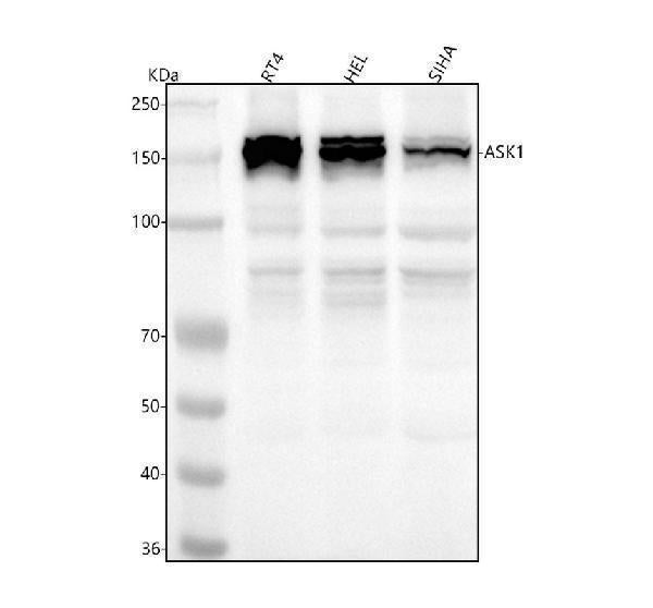 Anti-ASK1 MAP3K5 Rabbit Monoclonal Antibody