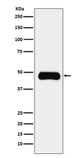 Western blot analysis of Insulin Receptor R expression in Daudi cell lysate.