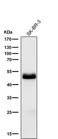 All lanes use the Antibody at 1:1K dilution for 1 hour at room temperature.