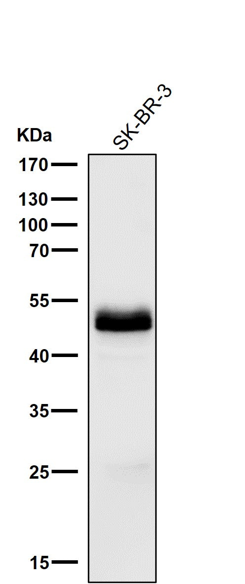 All lanes use the Antibody at 1:1K dilution for 1 hour at room temperature.